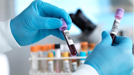 Alzheimer, un test del sangue potrebbe predire il declino cognitivo con dieci anni di anticipo