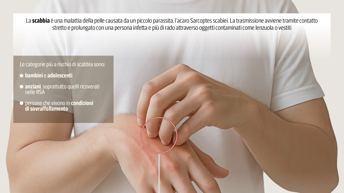 Sesto Fiorentino, 14 casi di scabbia in una Rsa: partite le procedure di contenimento