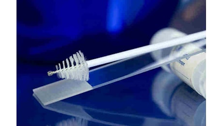 Screening oncologici, oltre 7,6 milioni fuori dai programmi gratuiti