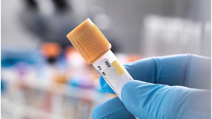 Hiv, la Prep a lunga durata anche in Italia: potrebbe migliorare l’aderenza alla terapia - la Repubblica