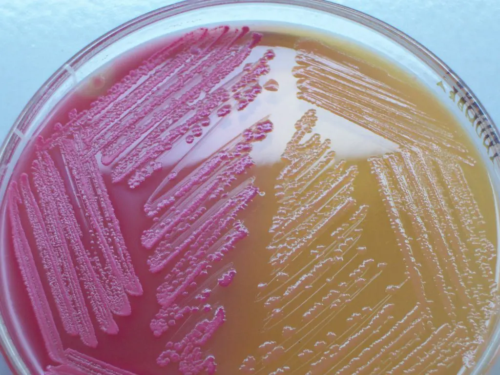 Escherichia coli: tre bimbi in ospedale. Asl indaga, Bastia frena sulle voci